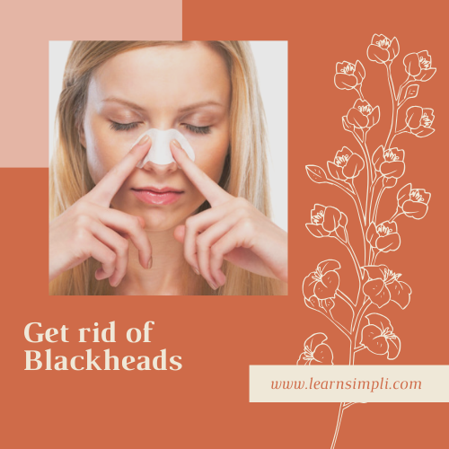 Get rid of Blackheads