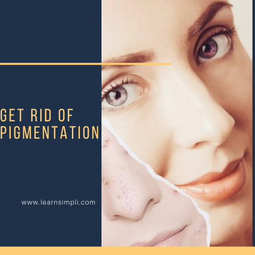 Get rid of pigmentation
