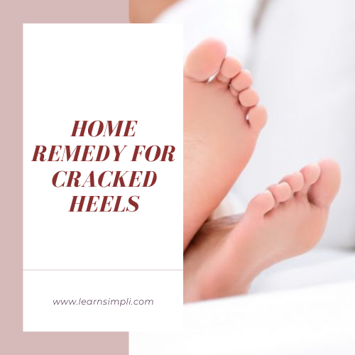 Home remedy for cracked heels